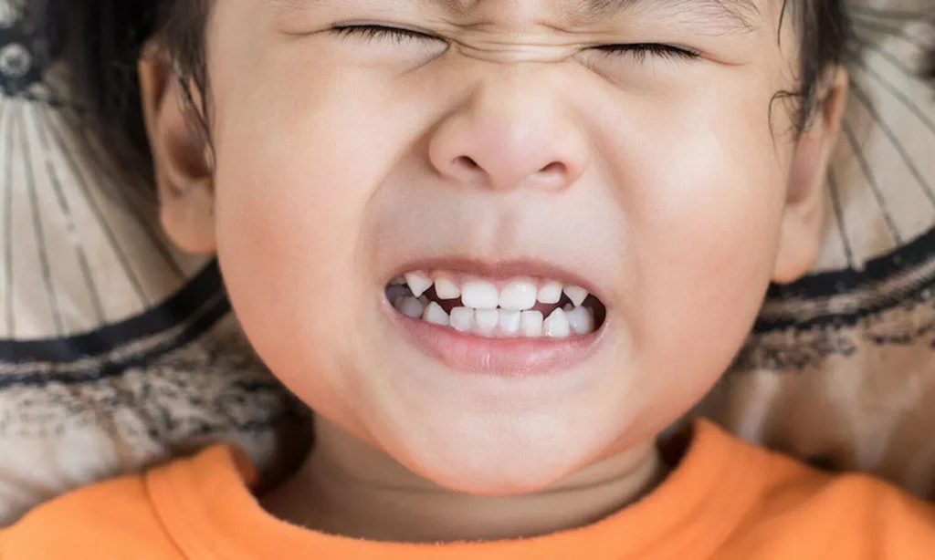 kill tooth pain nerve in 3 seconds permanently for kids